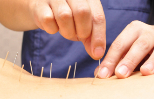 春宵堂治療院のセンキョ割イメージ